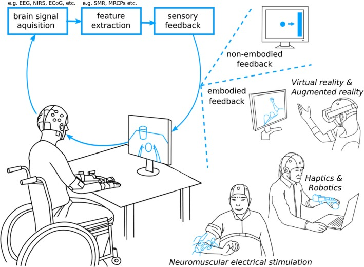 Scignabot: interfícies cervell-robot en neurorehabilitació